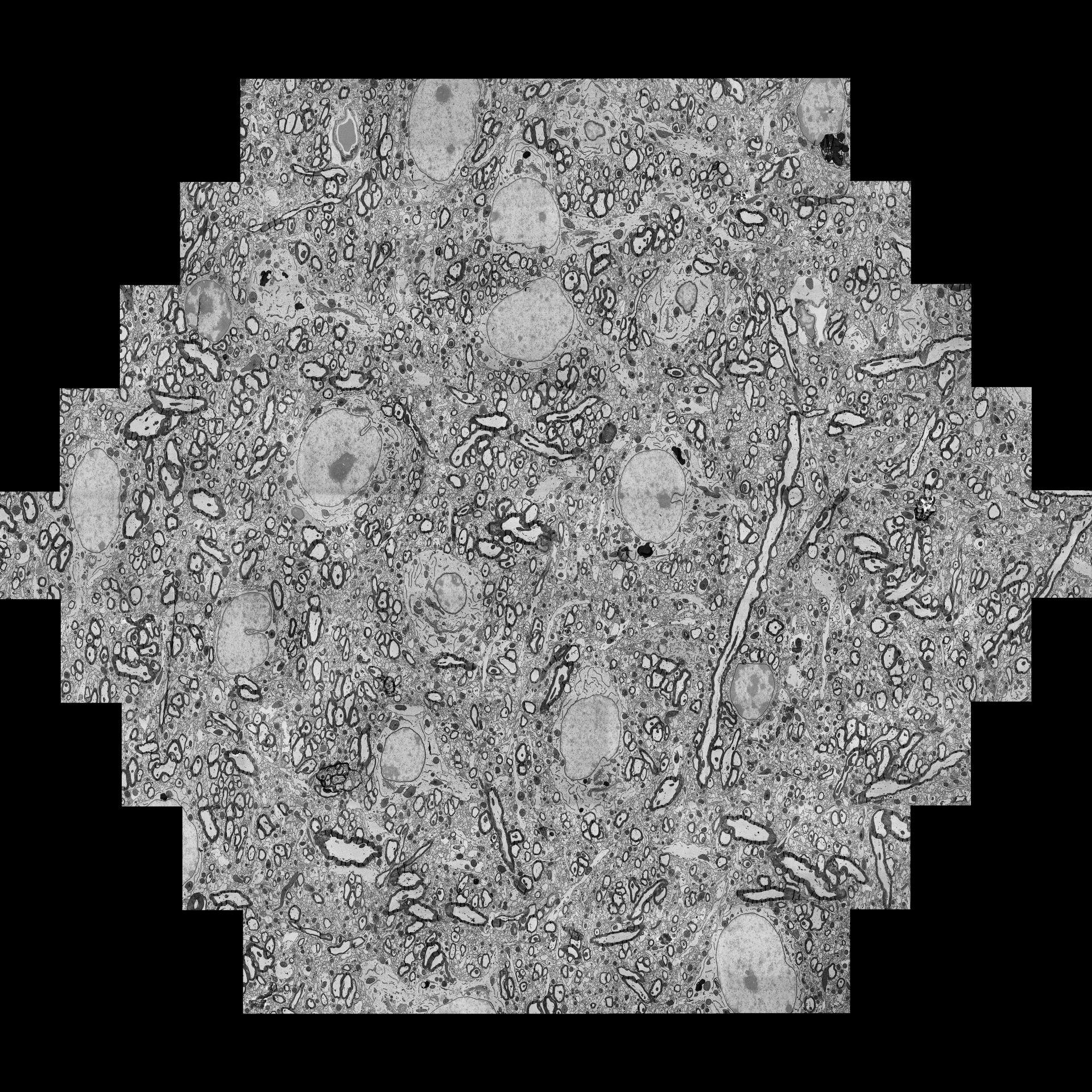 Beispiel für ein einzelnes mFoV, bestehend aus 61 einzelnen Bildkacheln, aufgenommen mit 61 parallelen Elektronenstrahlen, die von links nach rechts mehr als 100 µm abdecken, wobei die Aufnahme in der Regel nur wenige Sekunden dauert. 