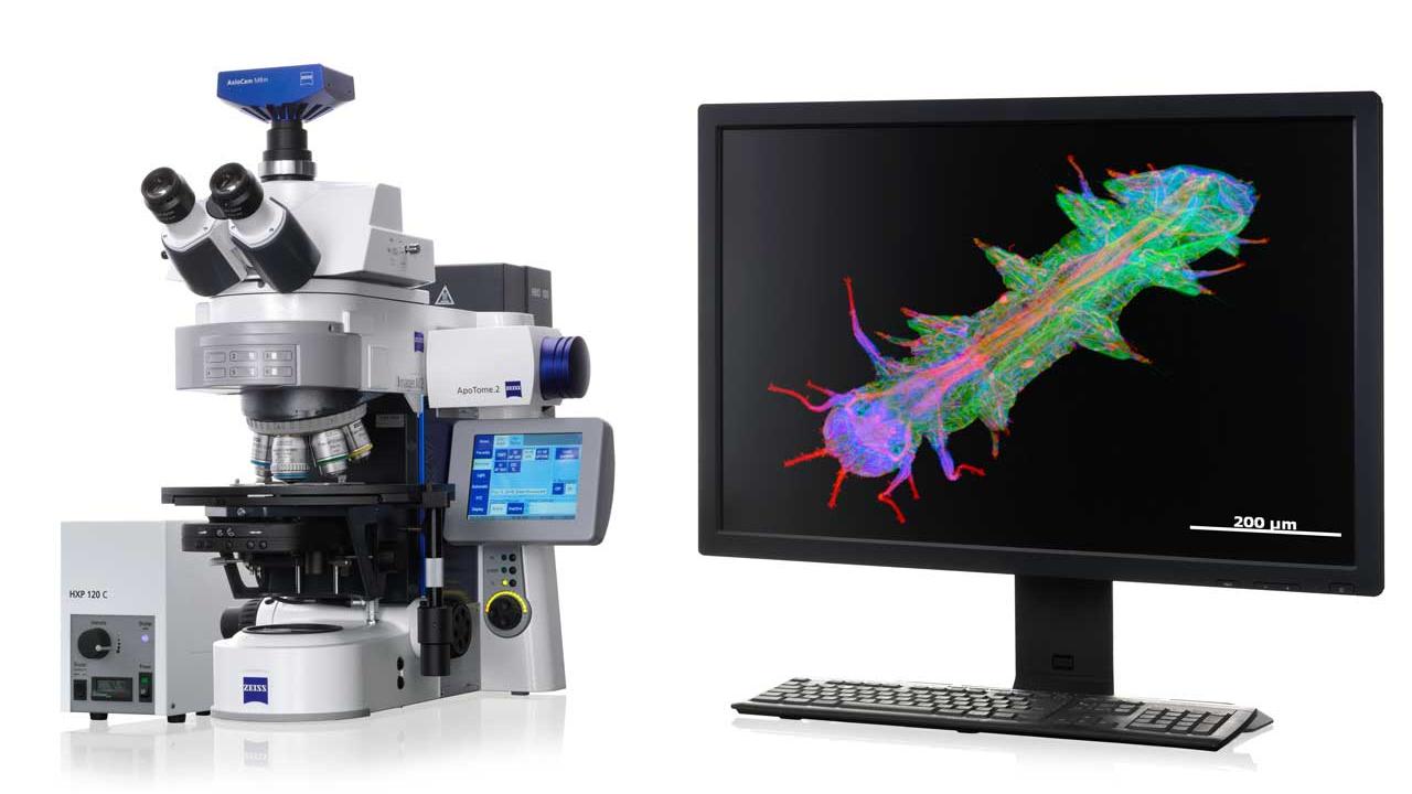 The ApoTome imaging process allows high-quality, economical optical sections to be produced by means of biological samples marked by fluorescence