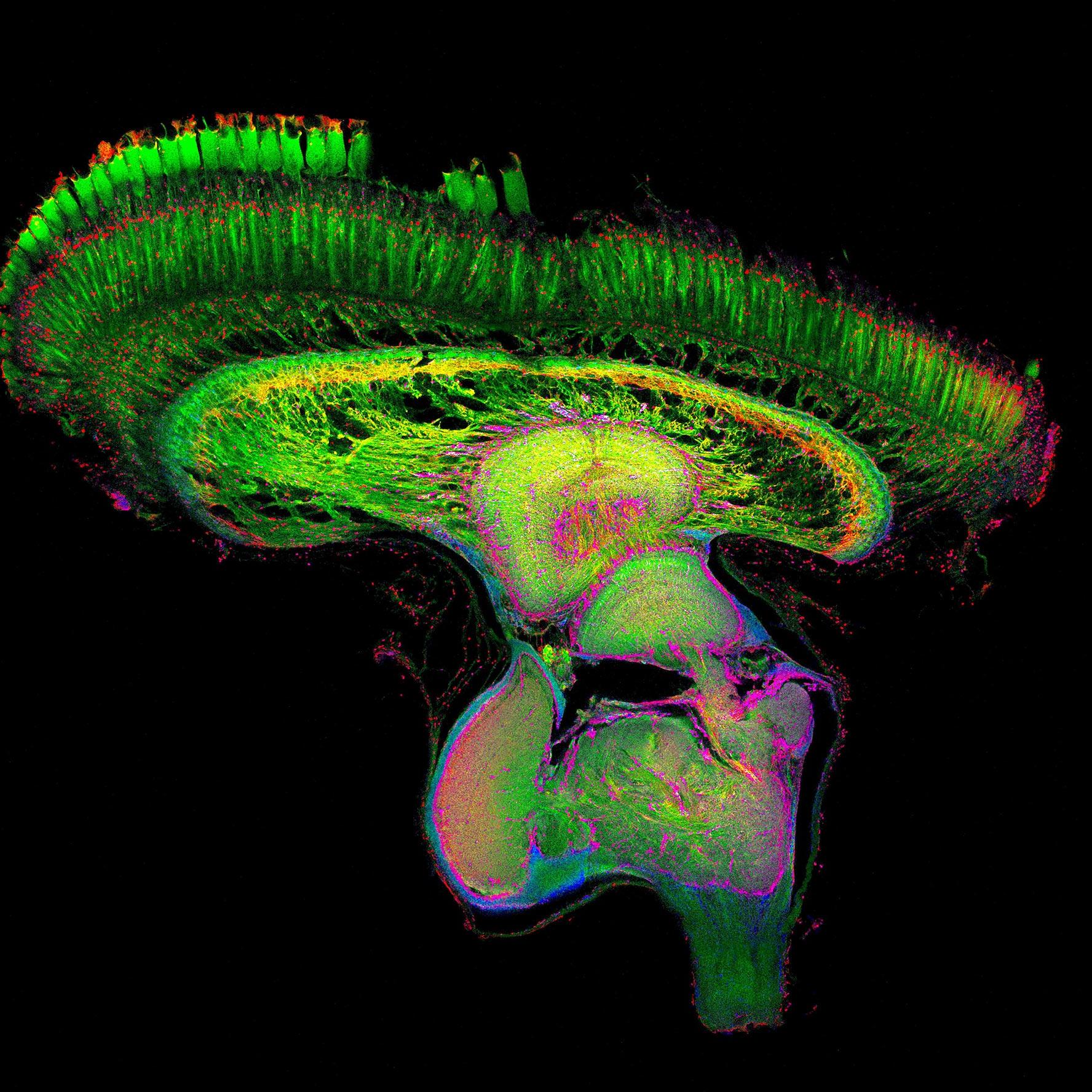 Mantis shrimps are marine creatures studied for their astounding visual capabilities. Research into these aggressive crustaceans is helping to pave the way for new biologically inspired technologies in areas like rapid cancer detection. Imaged with a ZEISS LSM 710 confocal microscope.