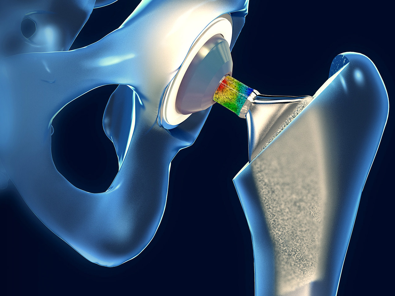 Mechanical property analysis of hip implant