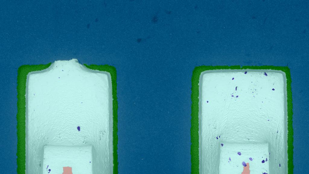 Deep learning for complex image processing | ZEISS