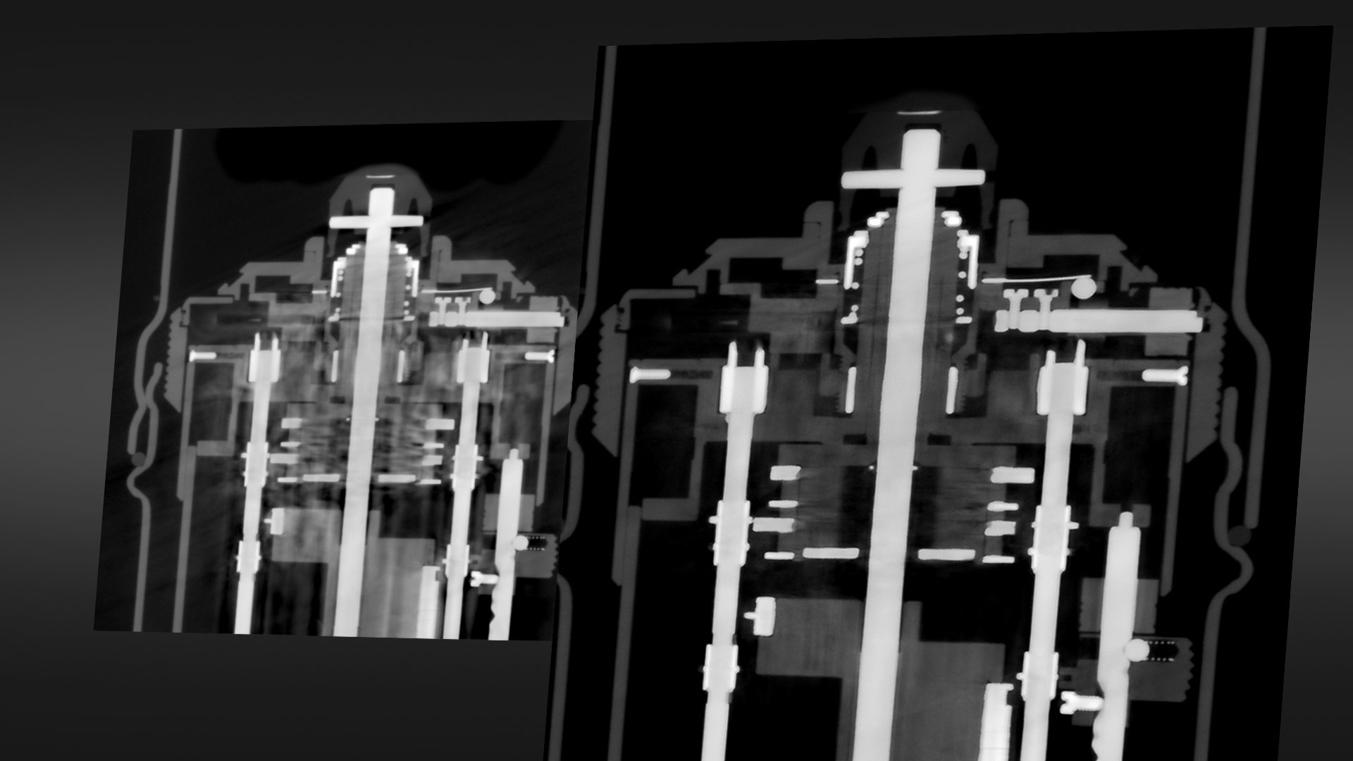 Advanced Mixed Material Artifact Reduction (AMMAR)​