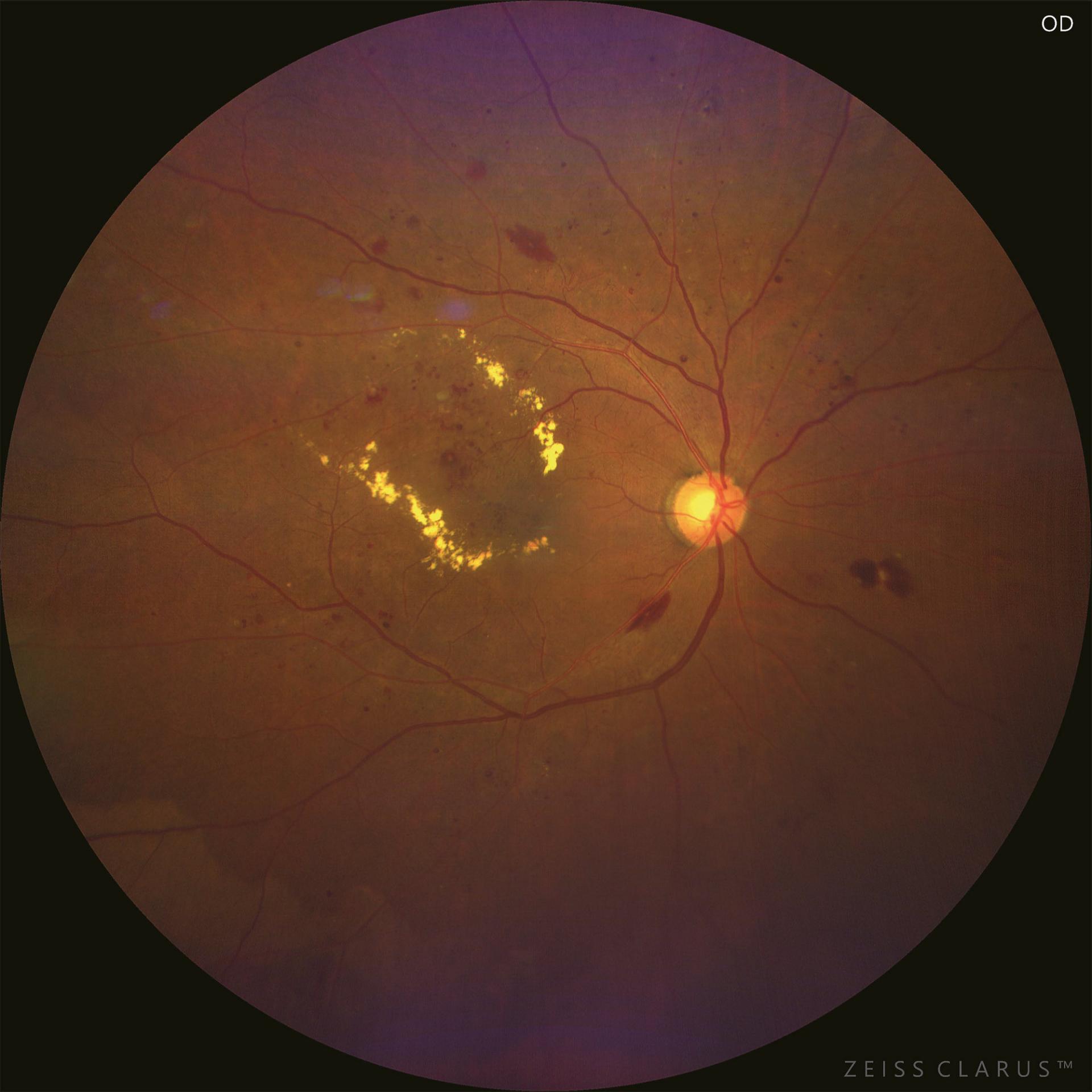 Magnified image of the macula