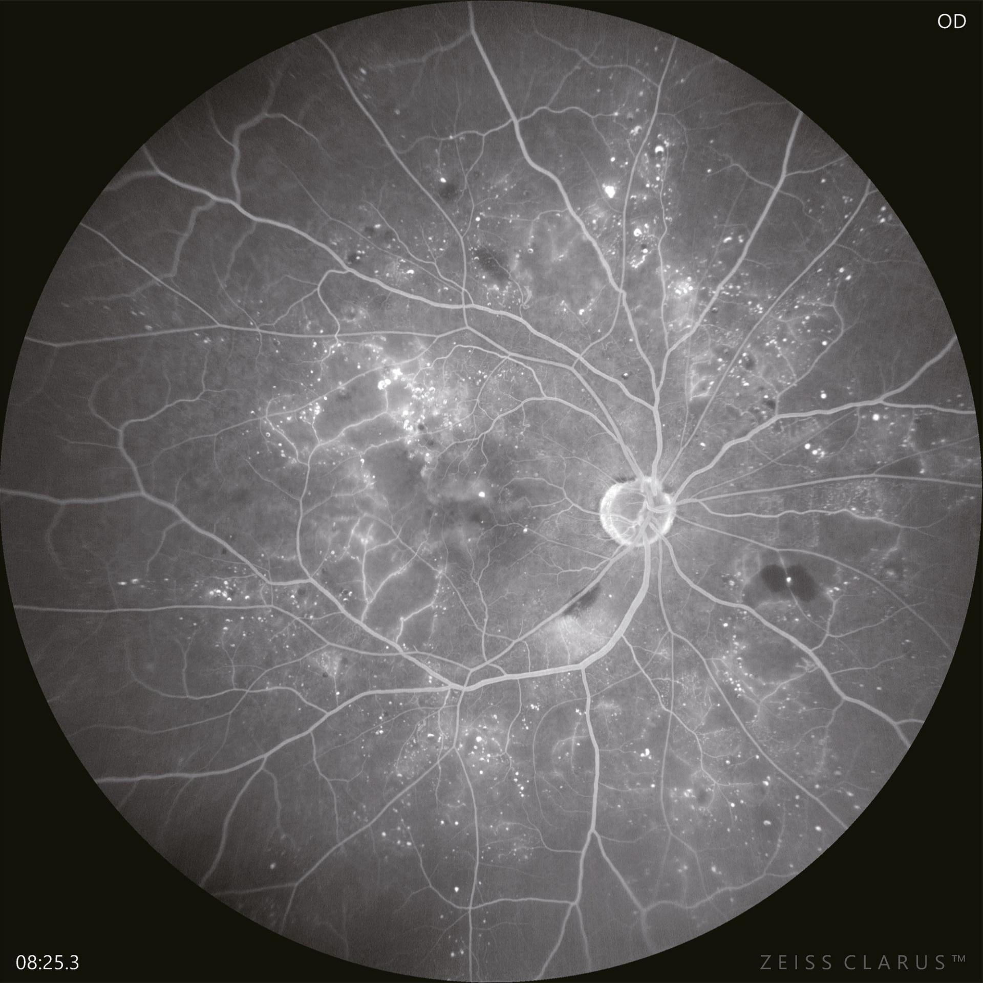 Magnified image of the FA macula