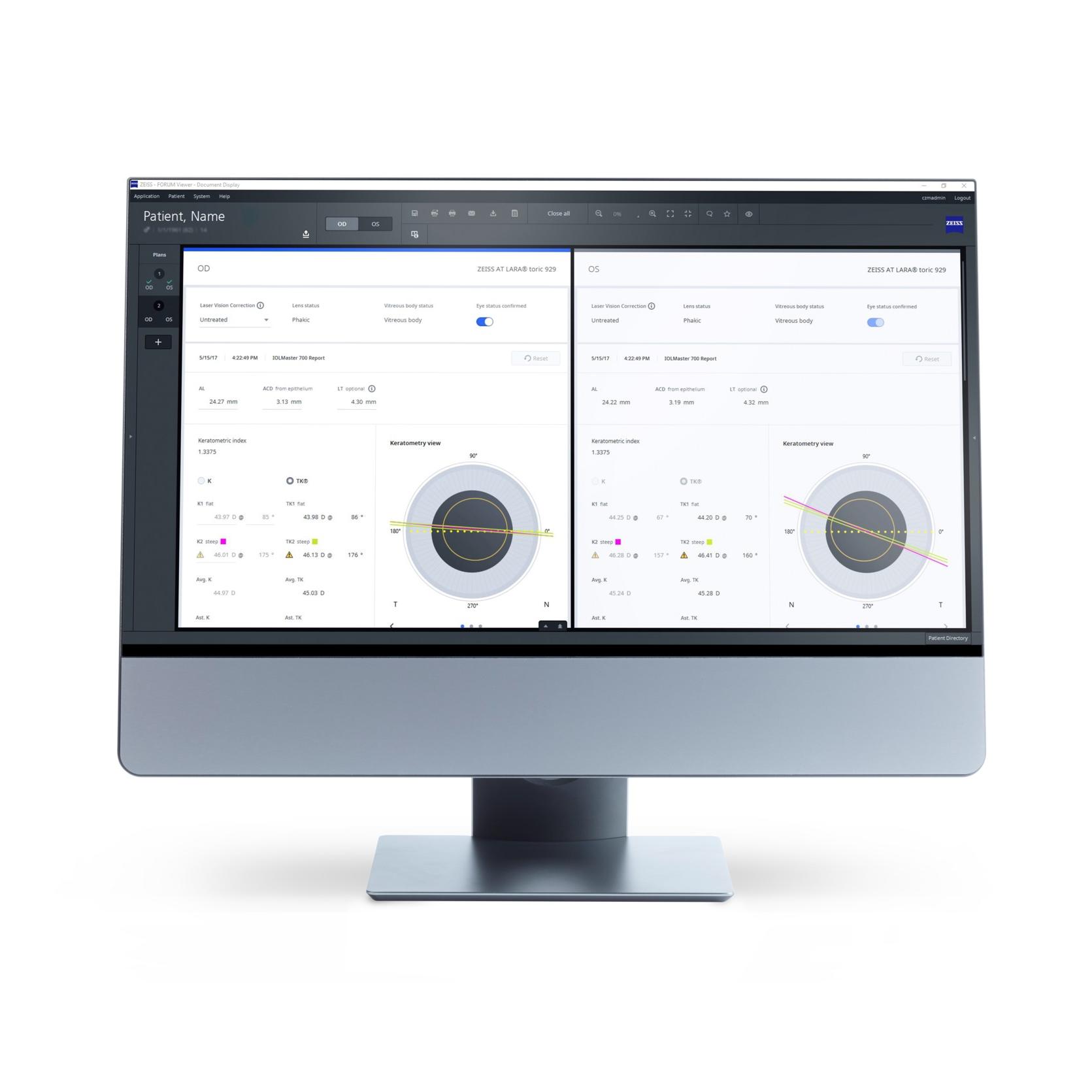 Image of a computer monitor with EQ Workplace from ZEISS