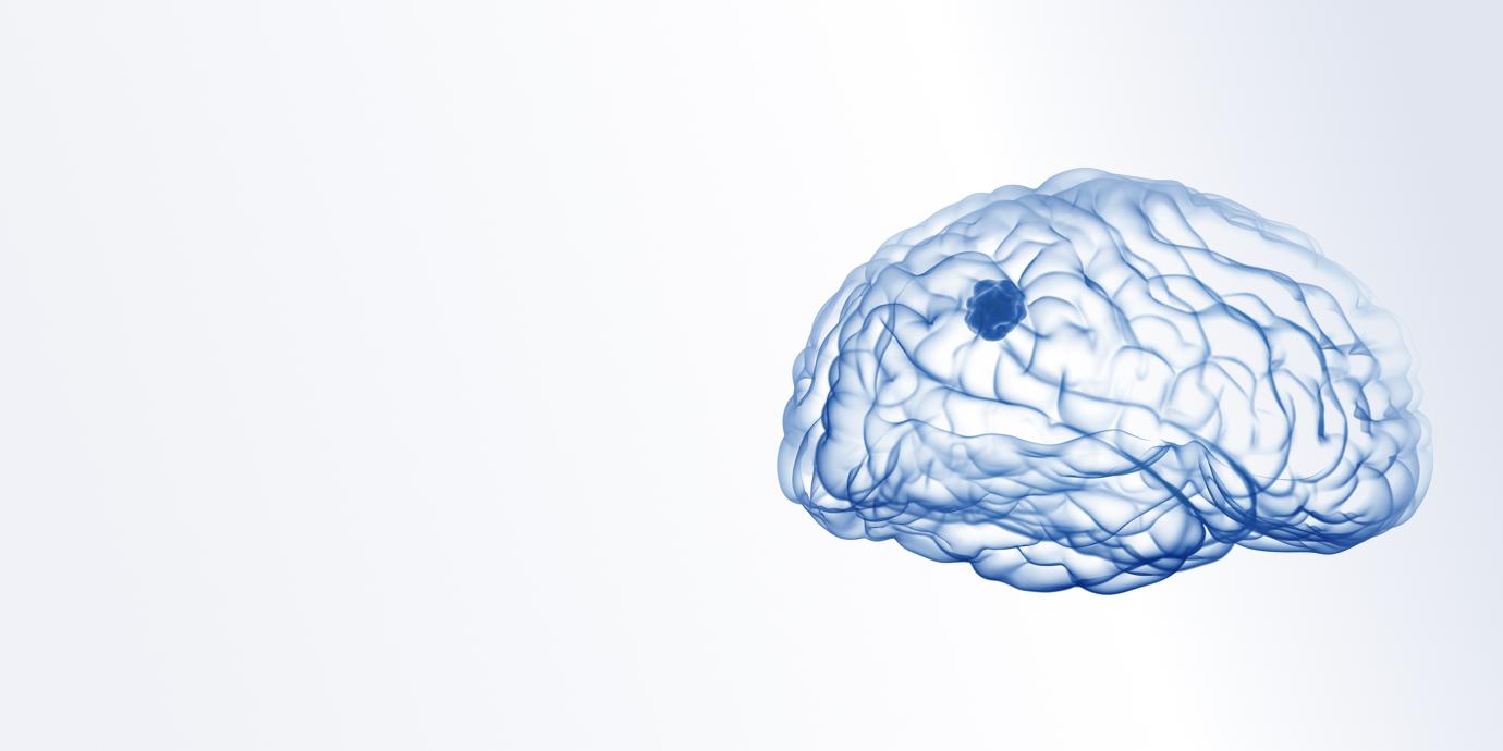 ZEISS Tumor Workflow