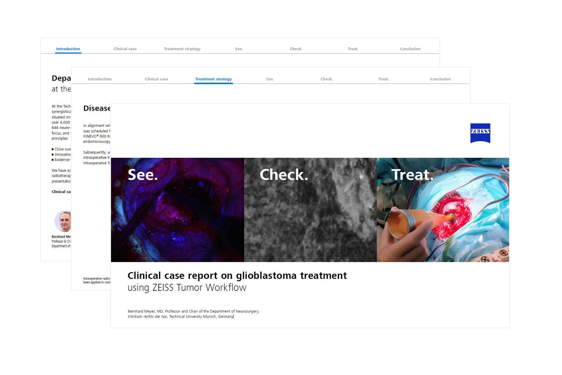 Relatório de caso clínico relativo ao tratamento do glioblastoma