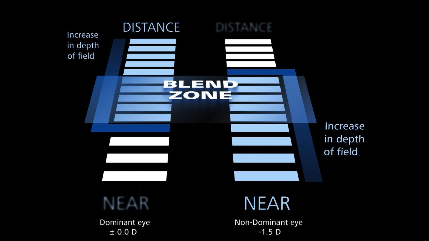 Key visual of CIRRUS PathFinder which automatically flags area of interest