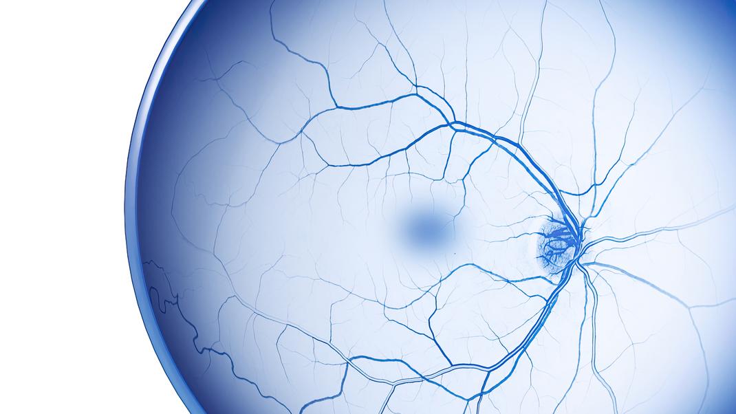  The ZEISS Retina Workflow: Optimizing retinal disease detection, management, and treatment.