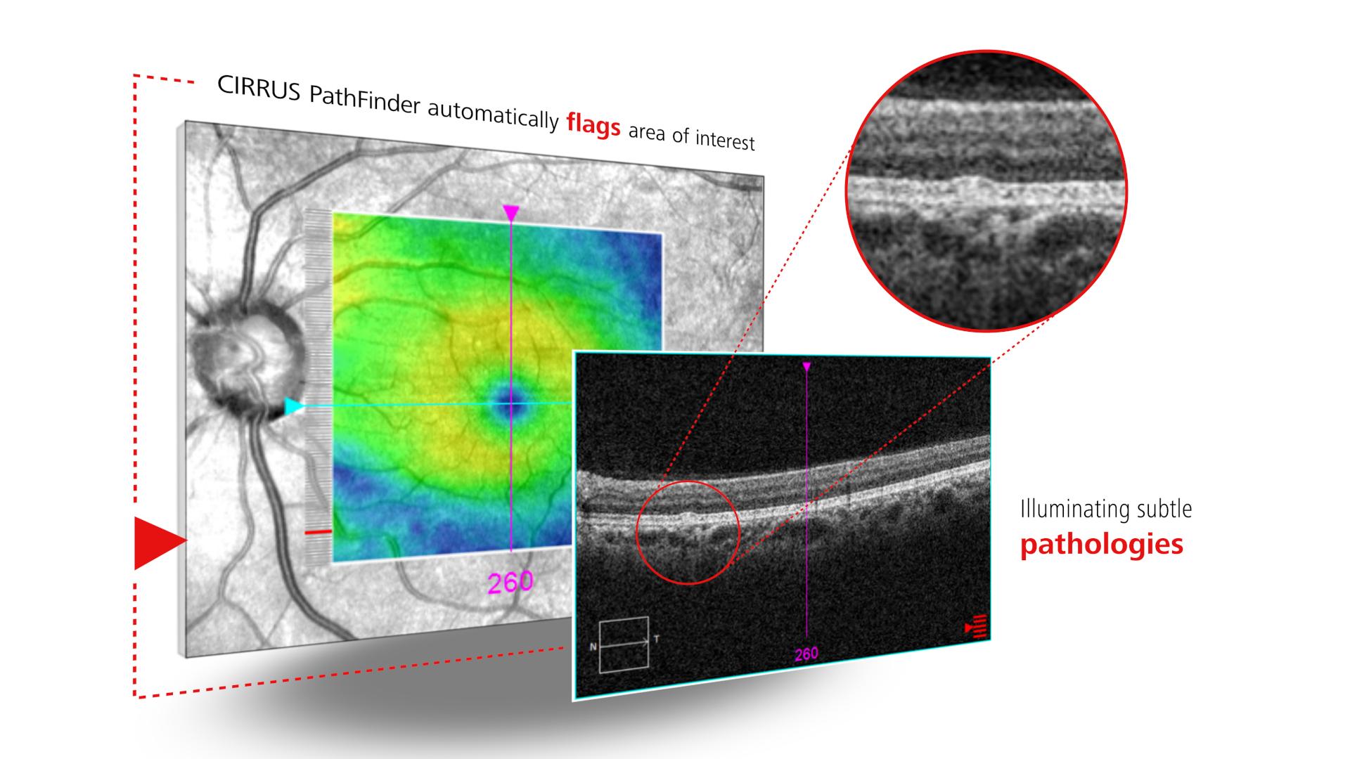 Key visual of CIRRUS PathFinder which automatically flags area of interest
