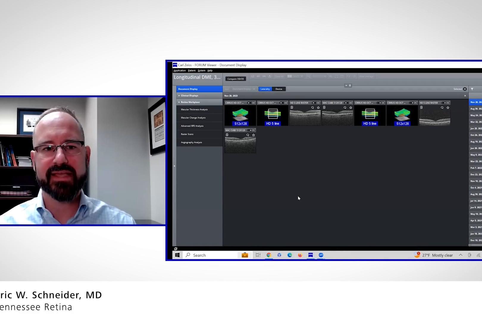 Overview of ZEISS FORUM with Retina Workplace: a case of macular edema