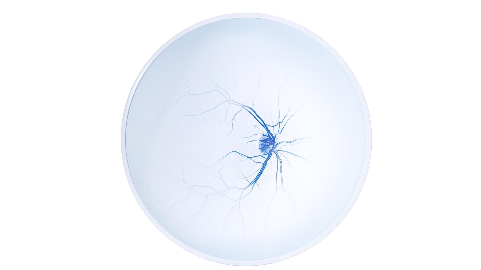 ZEISS Glaucoma Workflow