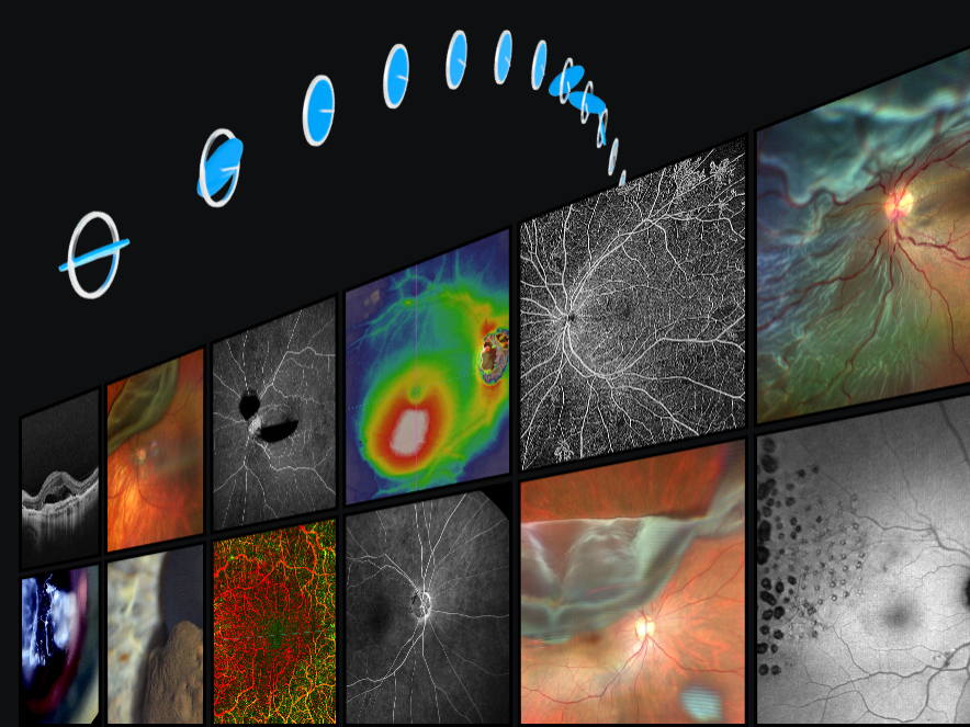 Multiple detailed eye scan images are displayed in a grid on the right, with a sequence of BDI agents transitioning across a black background from left to right.