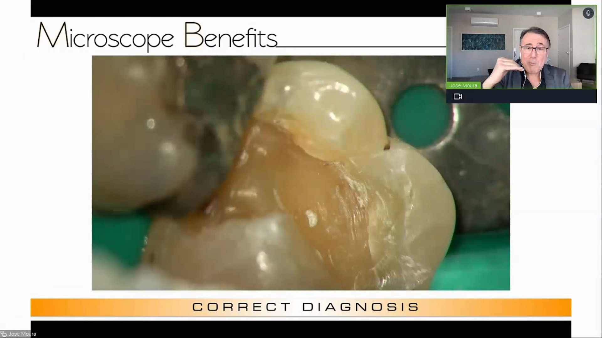 Magnification in endodontics: Necessity vs. fantasy