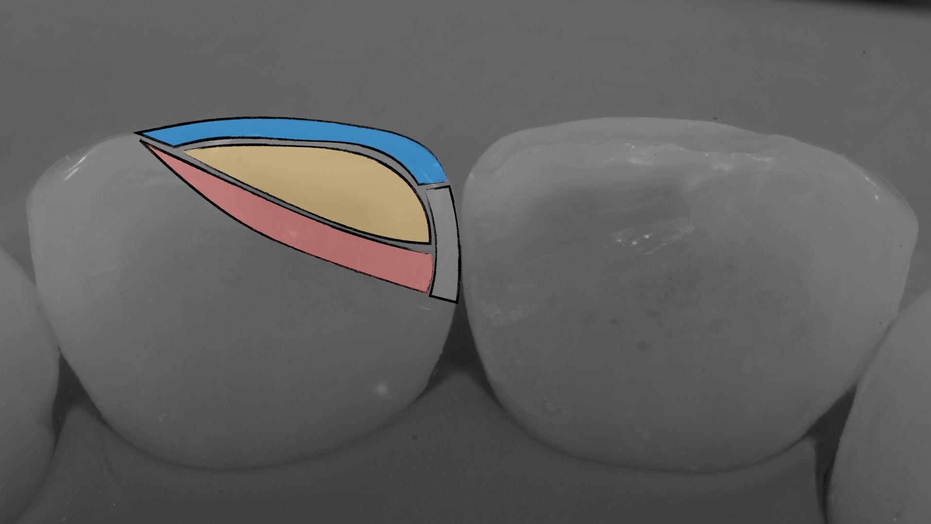 Restauraciones directas y microscopios
