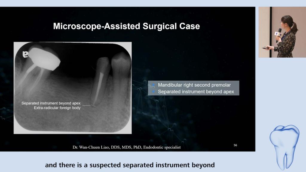 Vital Pulp Therapy: Pulp Assessment and Management