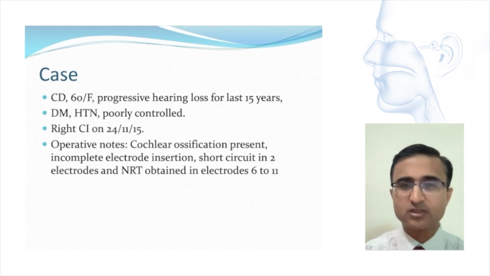 Tricky cochlear implant surgery made less scabrous by better optics - Dr. Grover