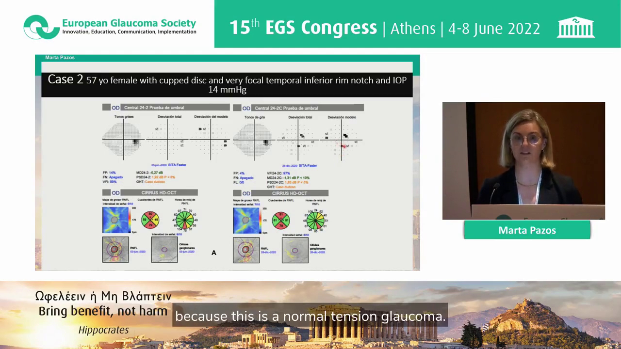 Integrated digital workflow in glaucoma - novel methodologies