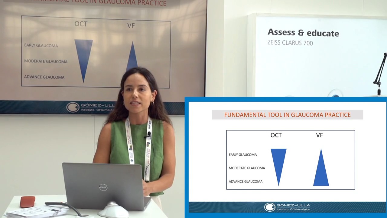 Optimización del uso de la OCT en la gestión de glaucoma, Sofia Porto Castro WGC 2023