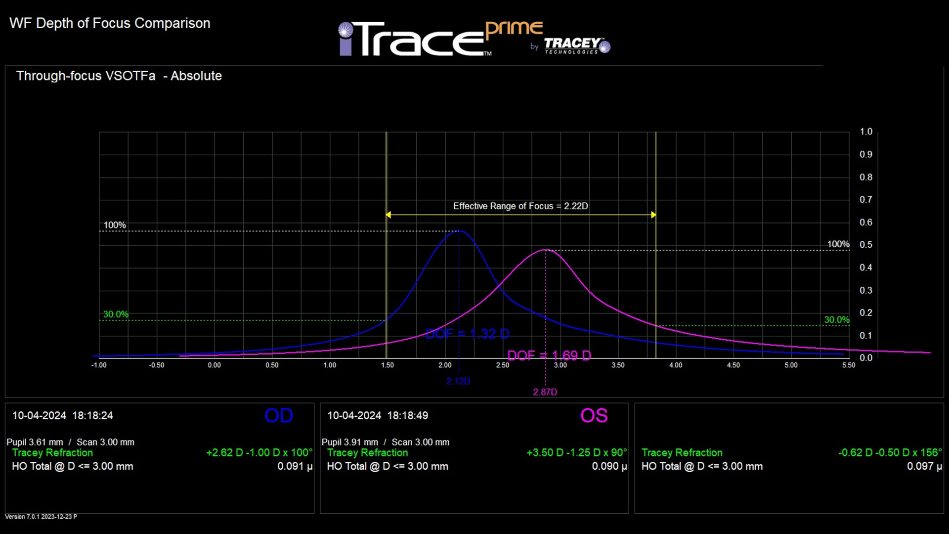 Depth of focus curve simulated on the iTrace pre-op PRESBYOND: effective range of focus 2.22 D binocularly