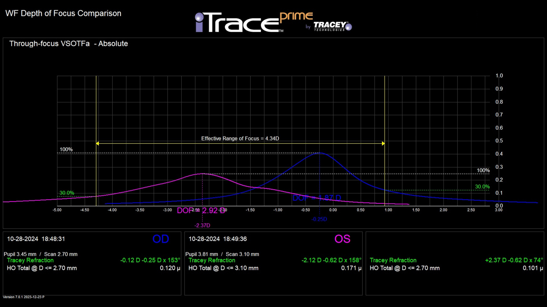 Depth of focus curve post op PRESBYOND: effective range of focus 4.34 D binocularly