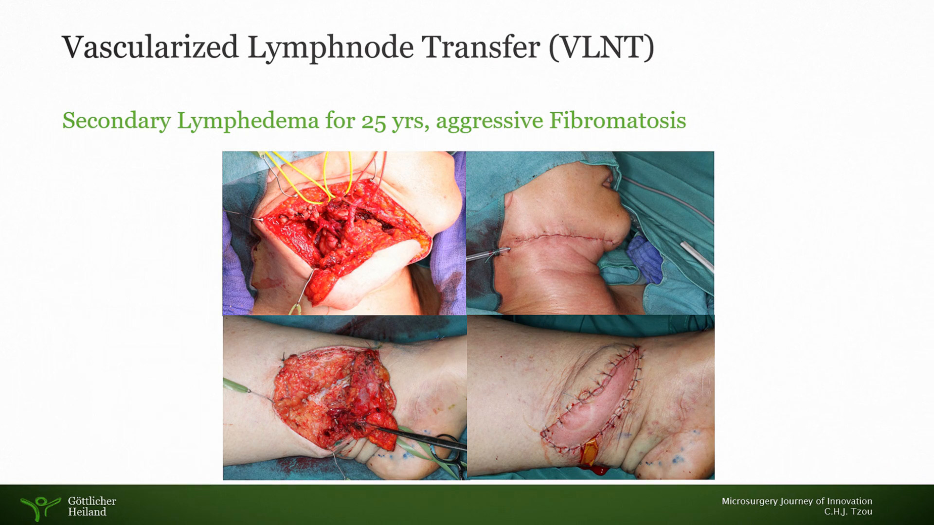 Validity of microscopy in plastic and reconstructive surgery