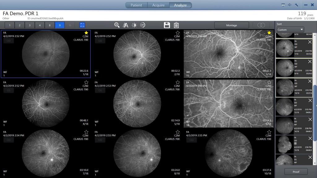 Clarus Normal ZEISS CLARUS 700 | ZEISS Medical Technology