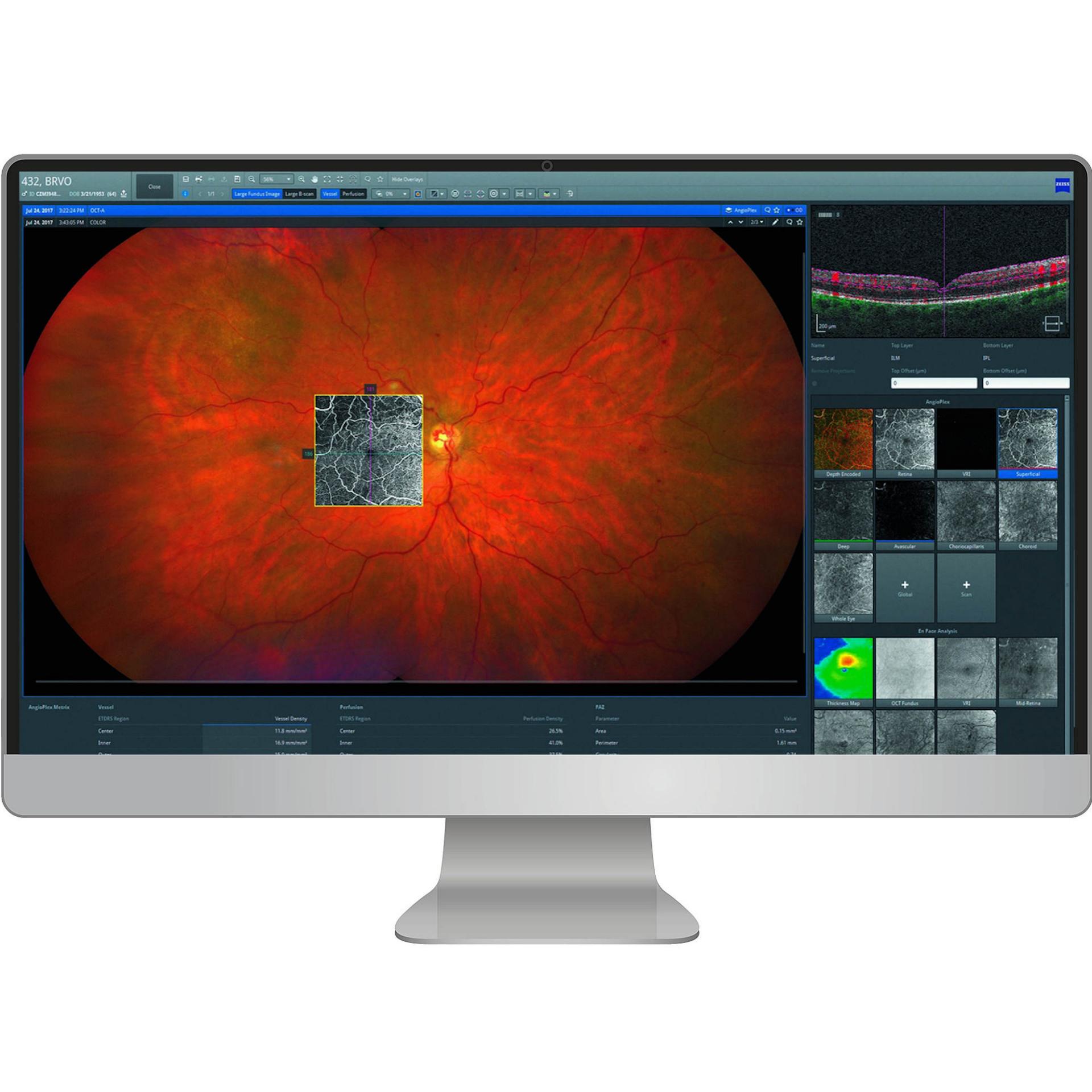 Retina Workplace