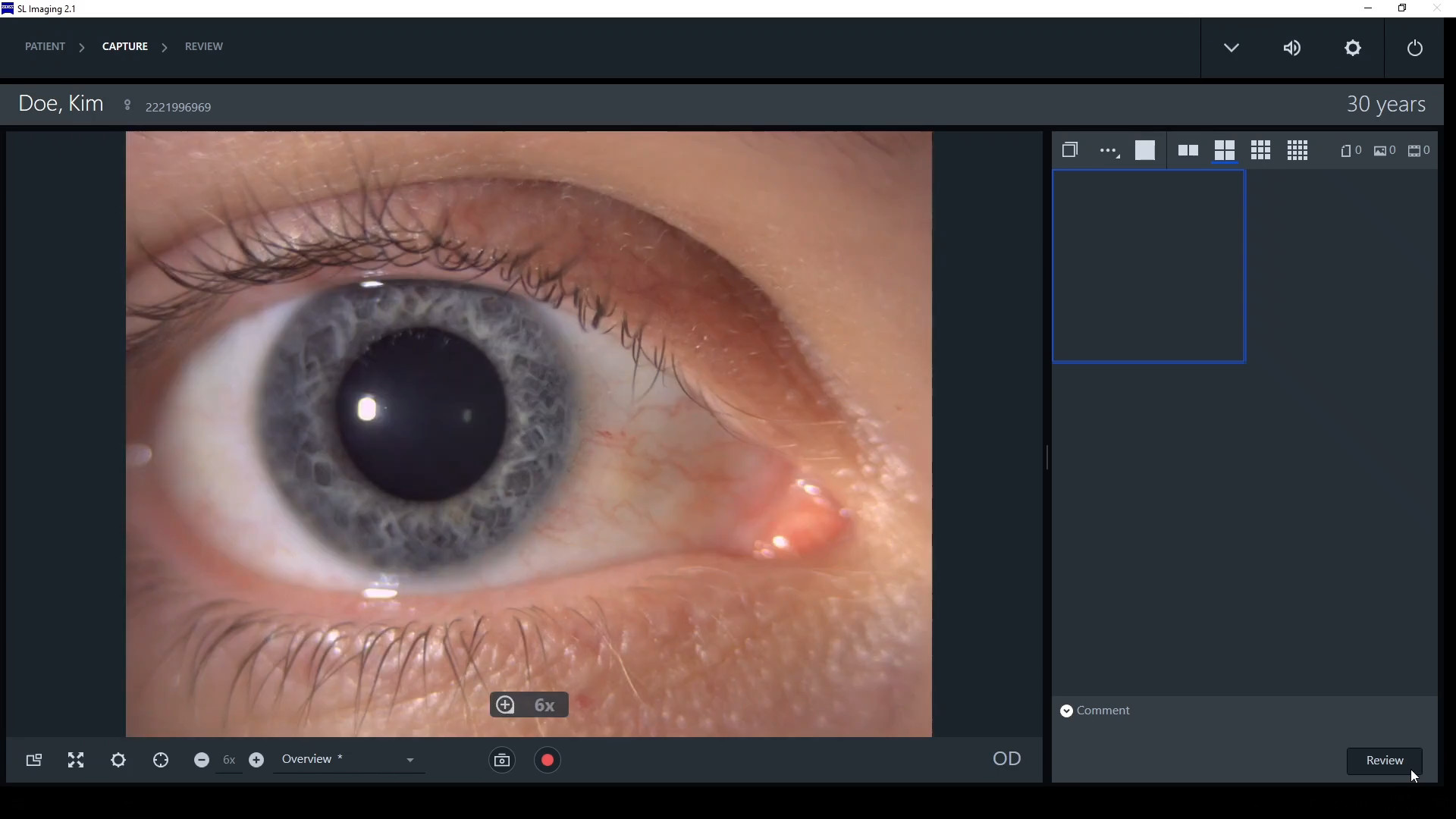 Cómo capturar imágenes y examinar estructuras externas del ojo