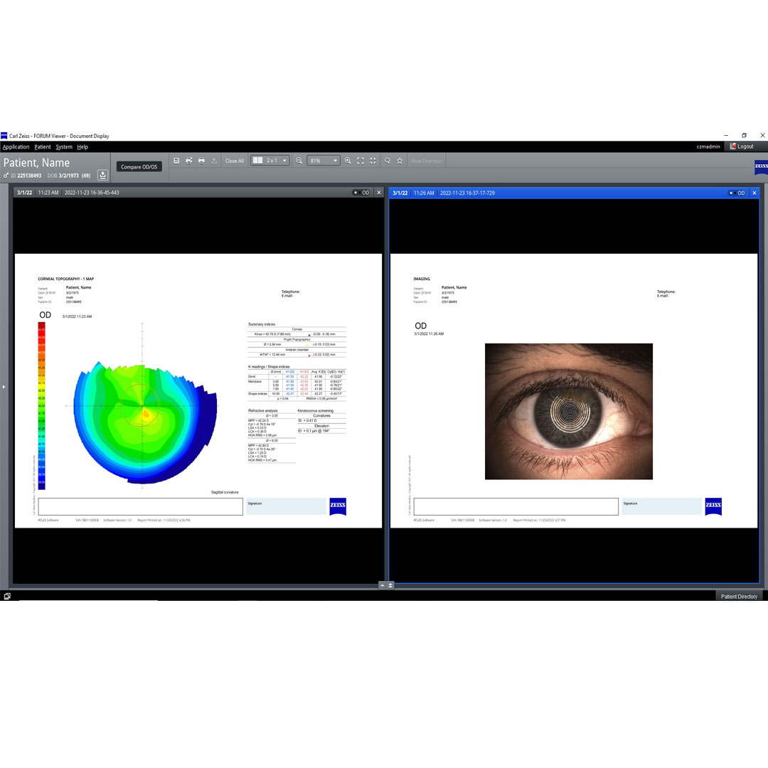 Multi-modality worklist in FORUM