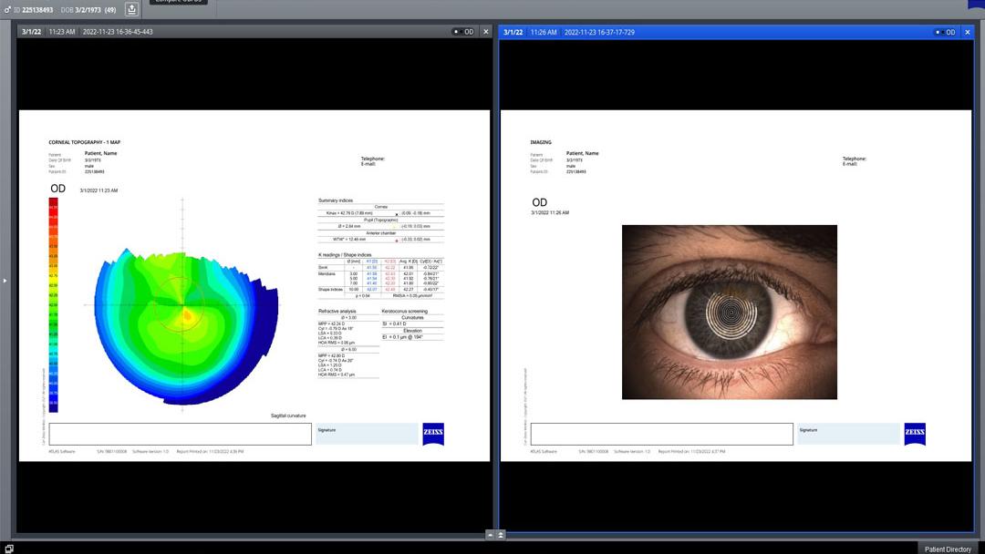 Multi-modality worklist in FORUM