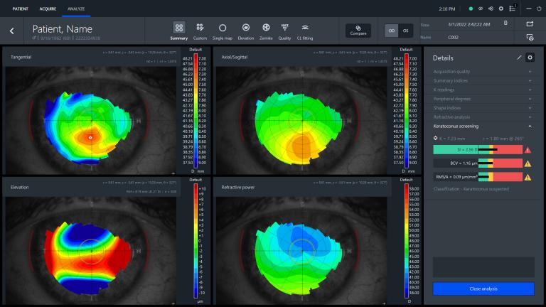 Topographer Machine ZEISS ATLAS 500 | ZEISS Medical Technology