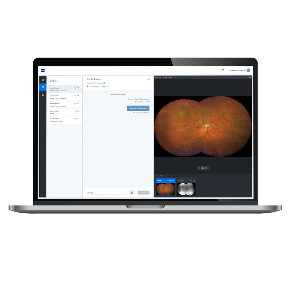 Illustration of ZEISS Collaborative Care