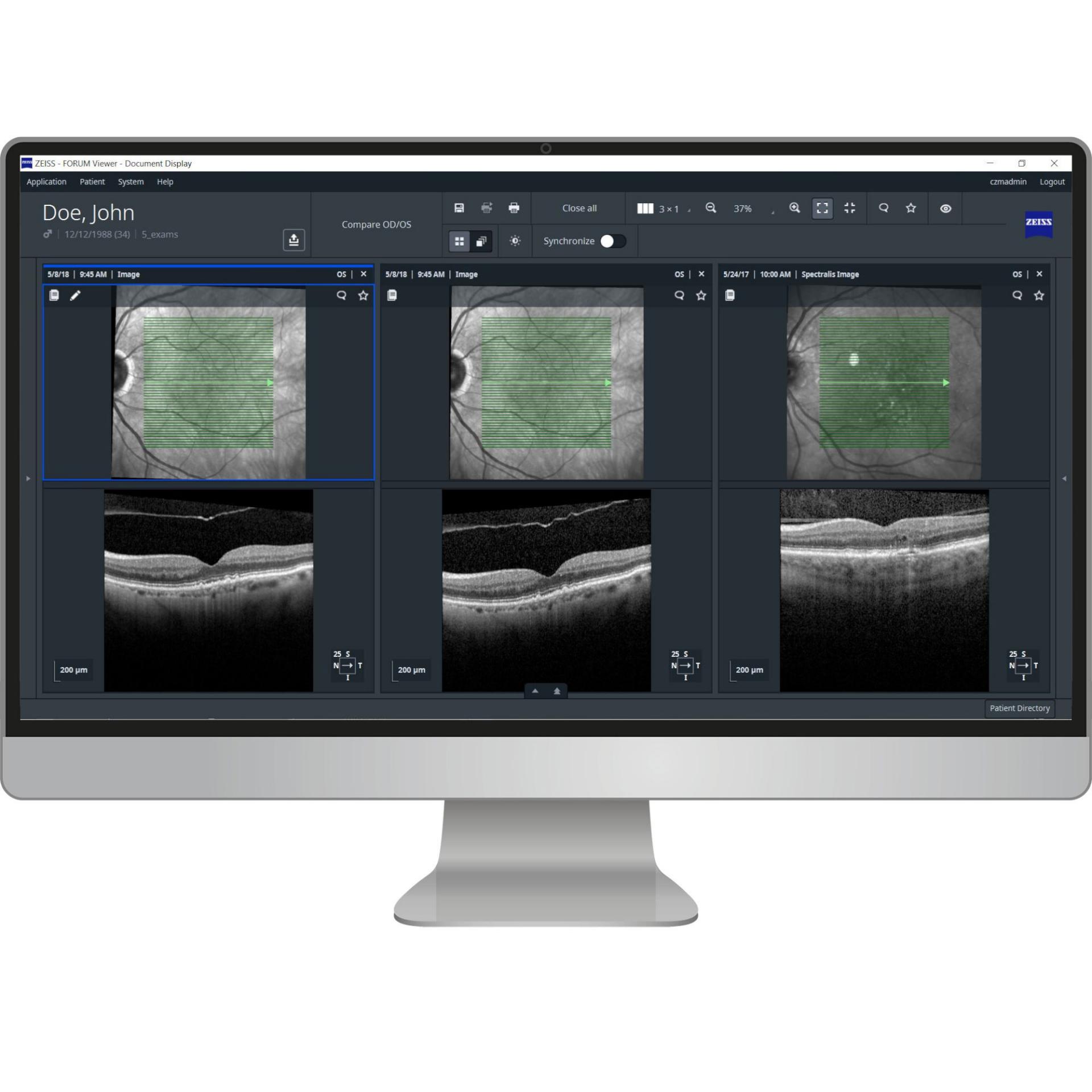 Ophthalmic data management