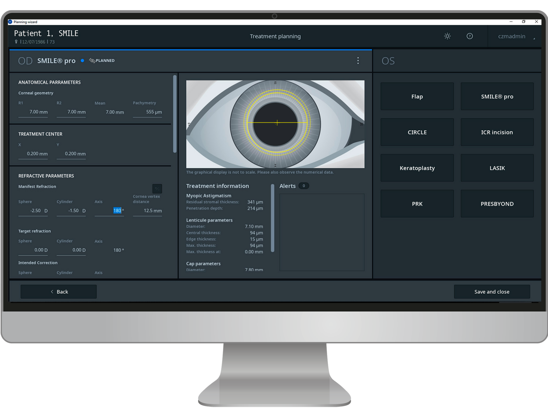 ZEISS Refractive Workplace