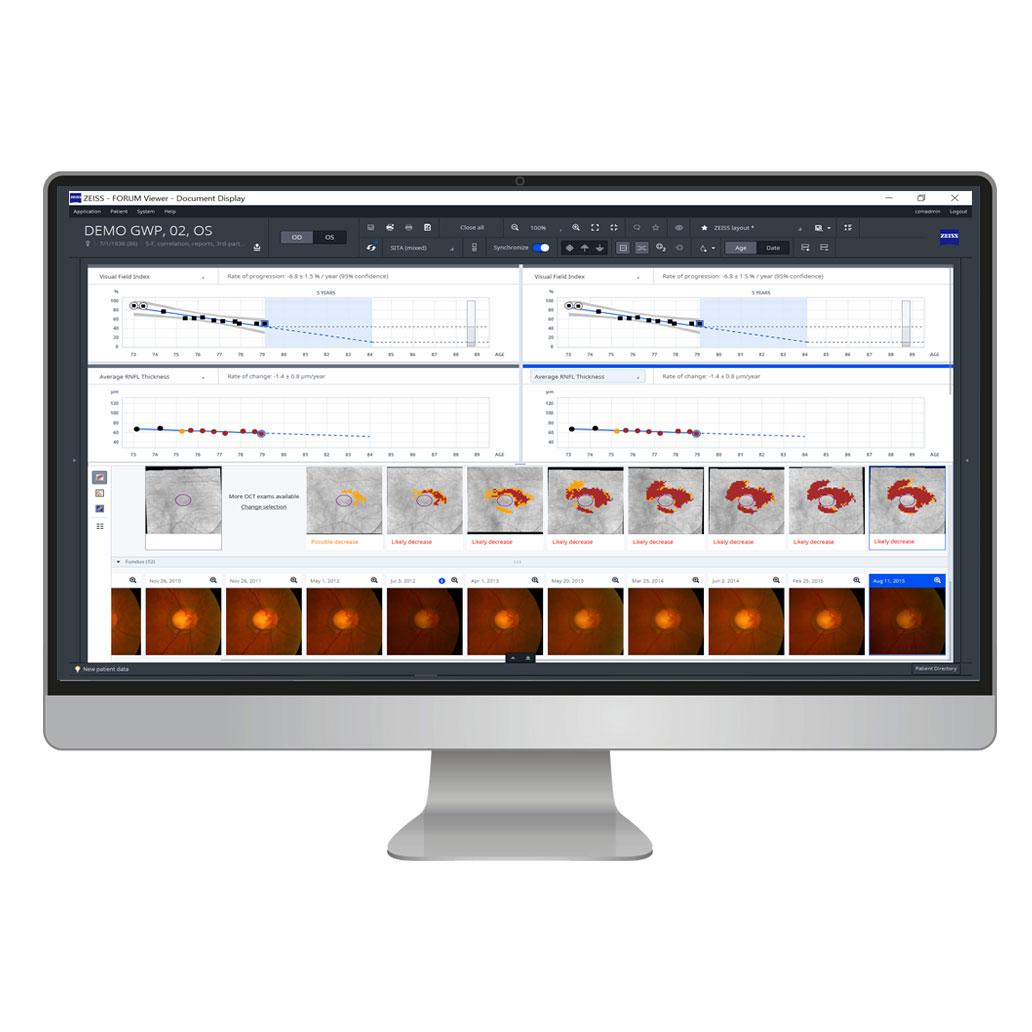 ZEISS Glaucoma Workplace