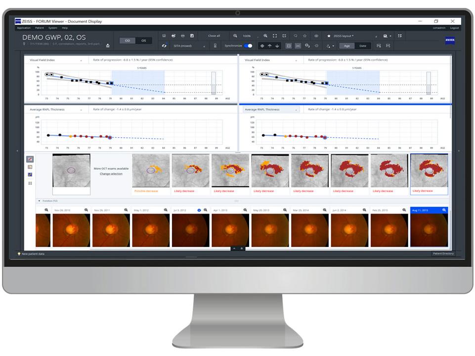 ZEISS Glaucoma Workplace