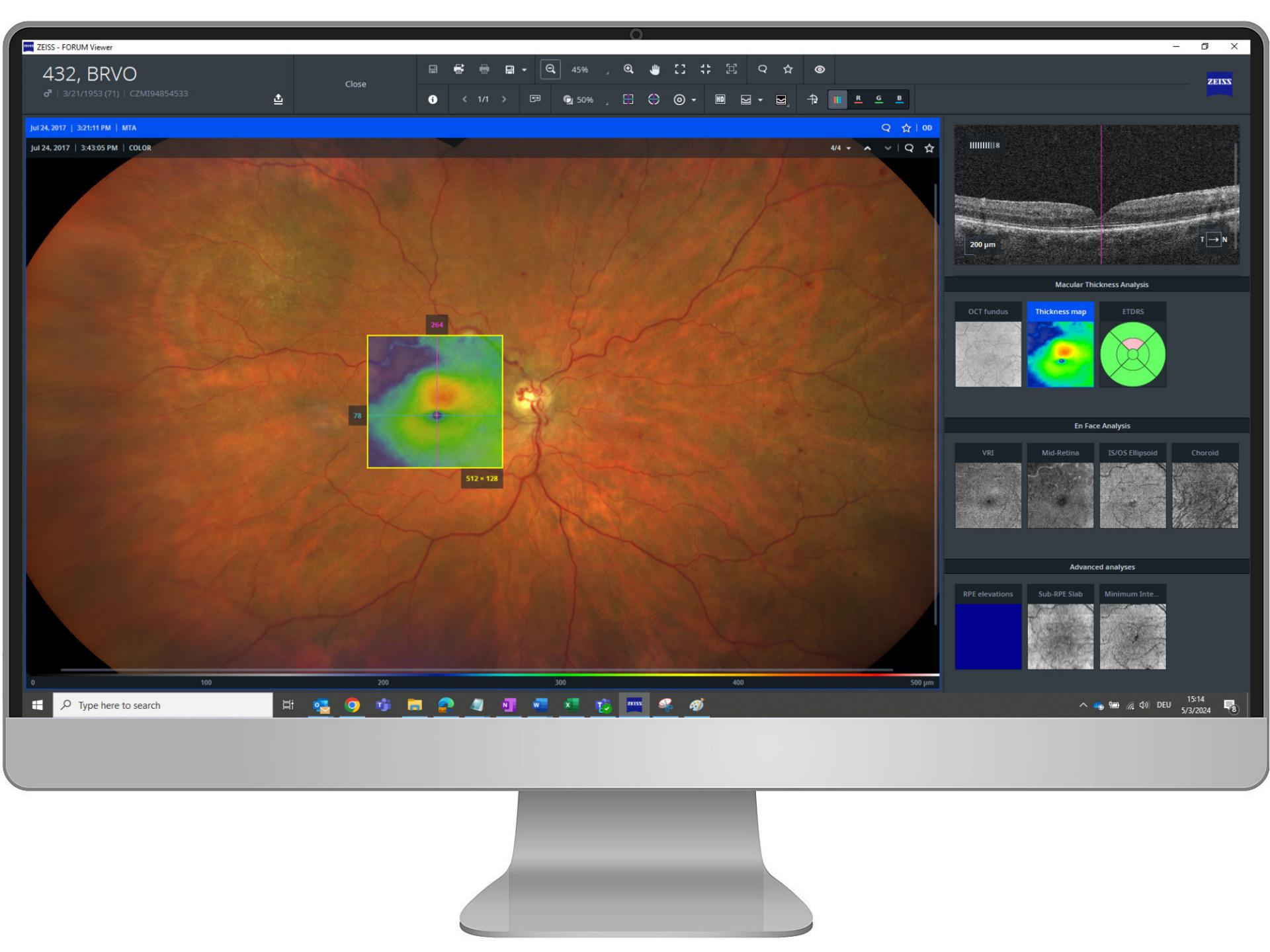ZEISS Retina Workplace