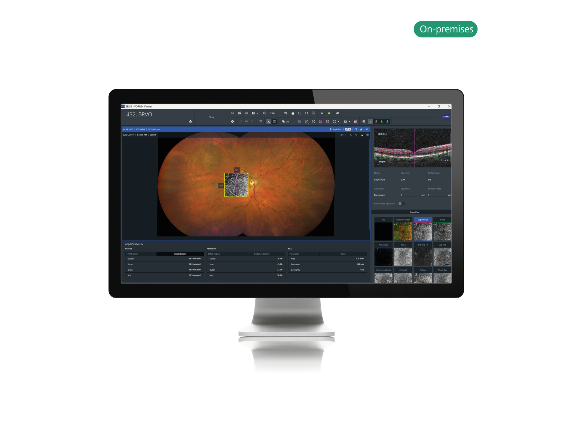 Retina Software ZEISS Research Data Platform