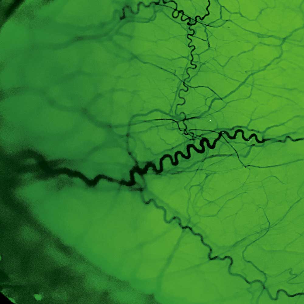 Filtro verde (“red free”)
