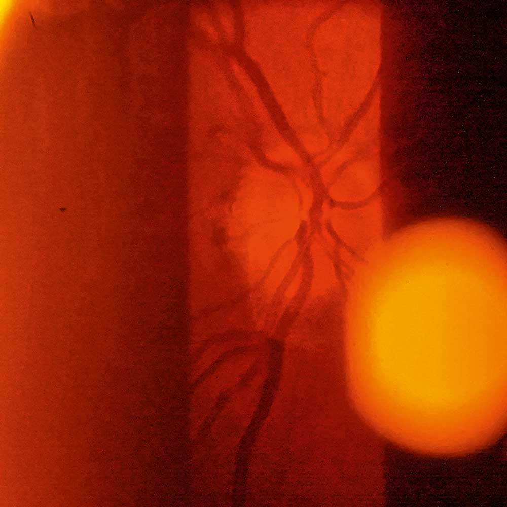 Filtro rosso