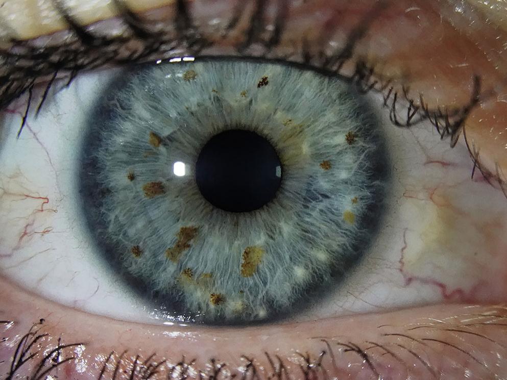 6x magnification of a blue iris