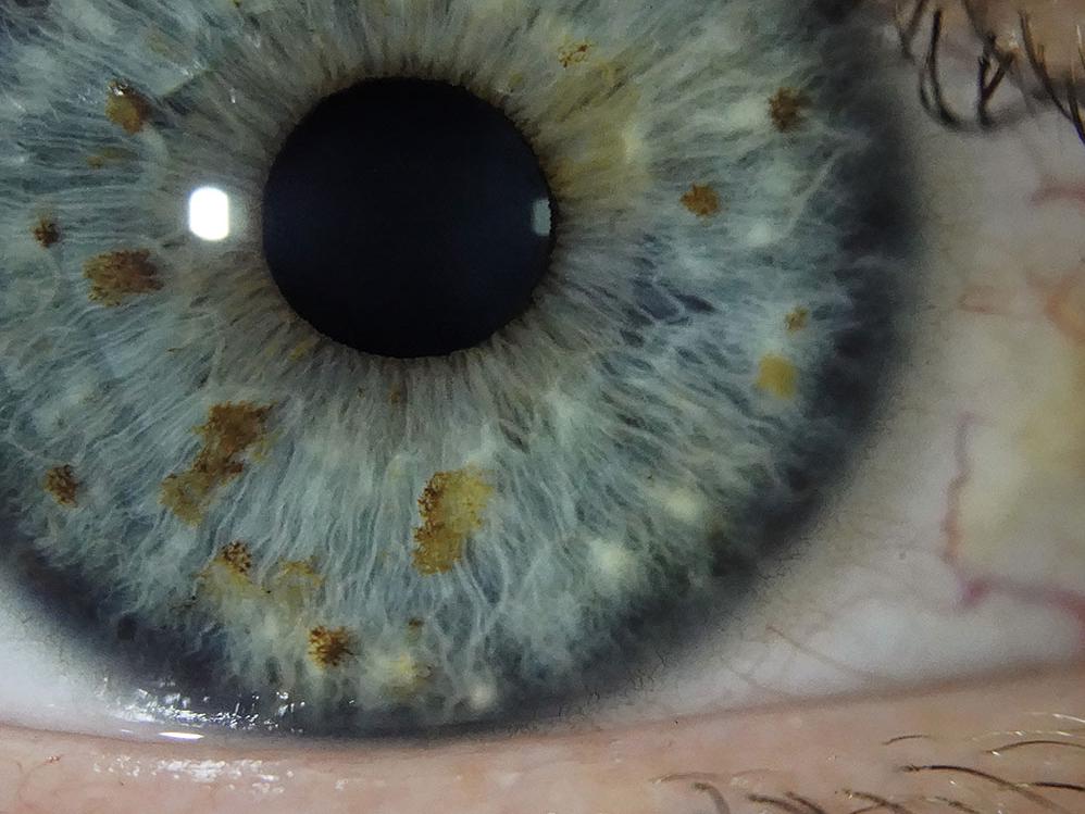 10x magnification of a blue iris