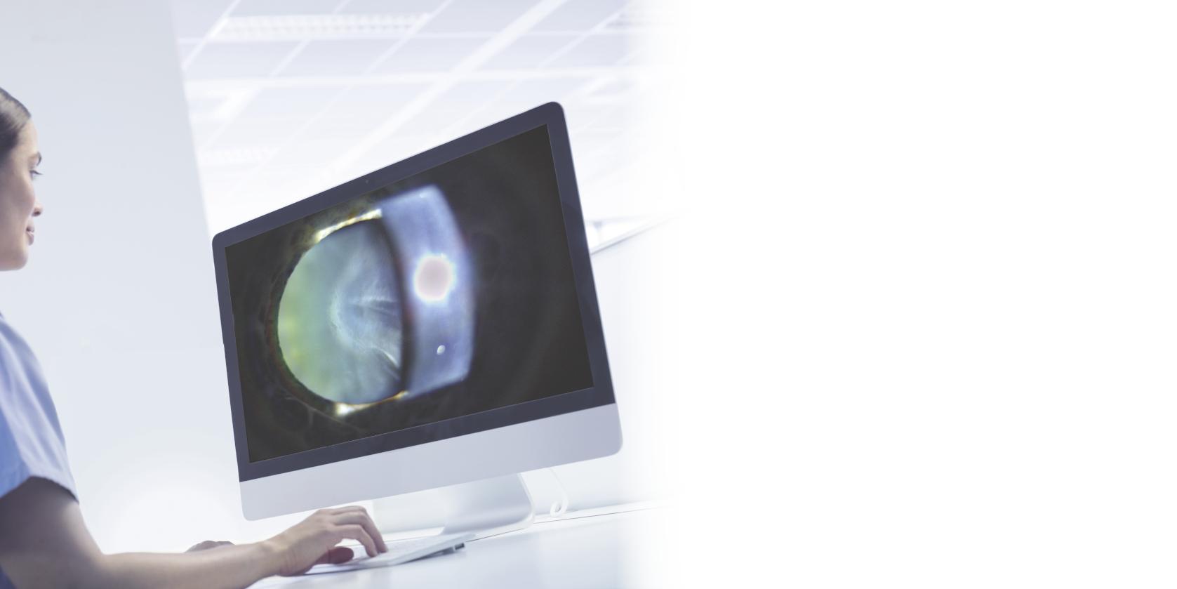 A medical professional is analyzing a detailed eye scan on a computer monitor displaying ZEISS imaging software.