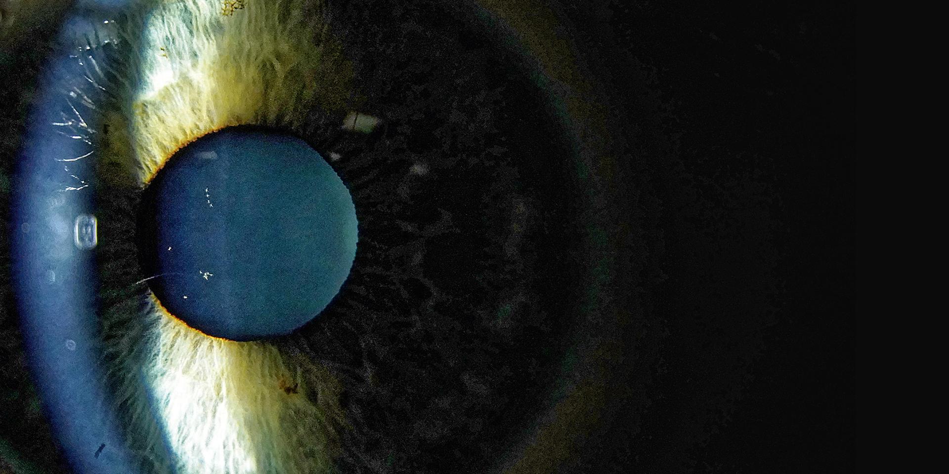 Numerose opzioni di illuminazione e filtri