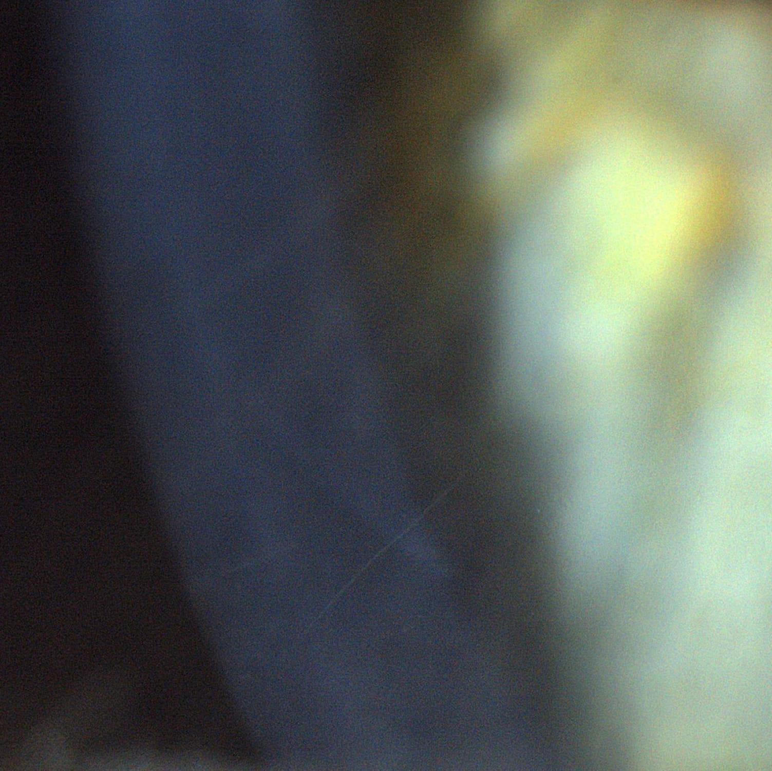 Faint corneal scars at high magnification after Lasik therapy