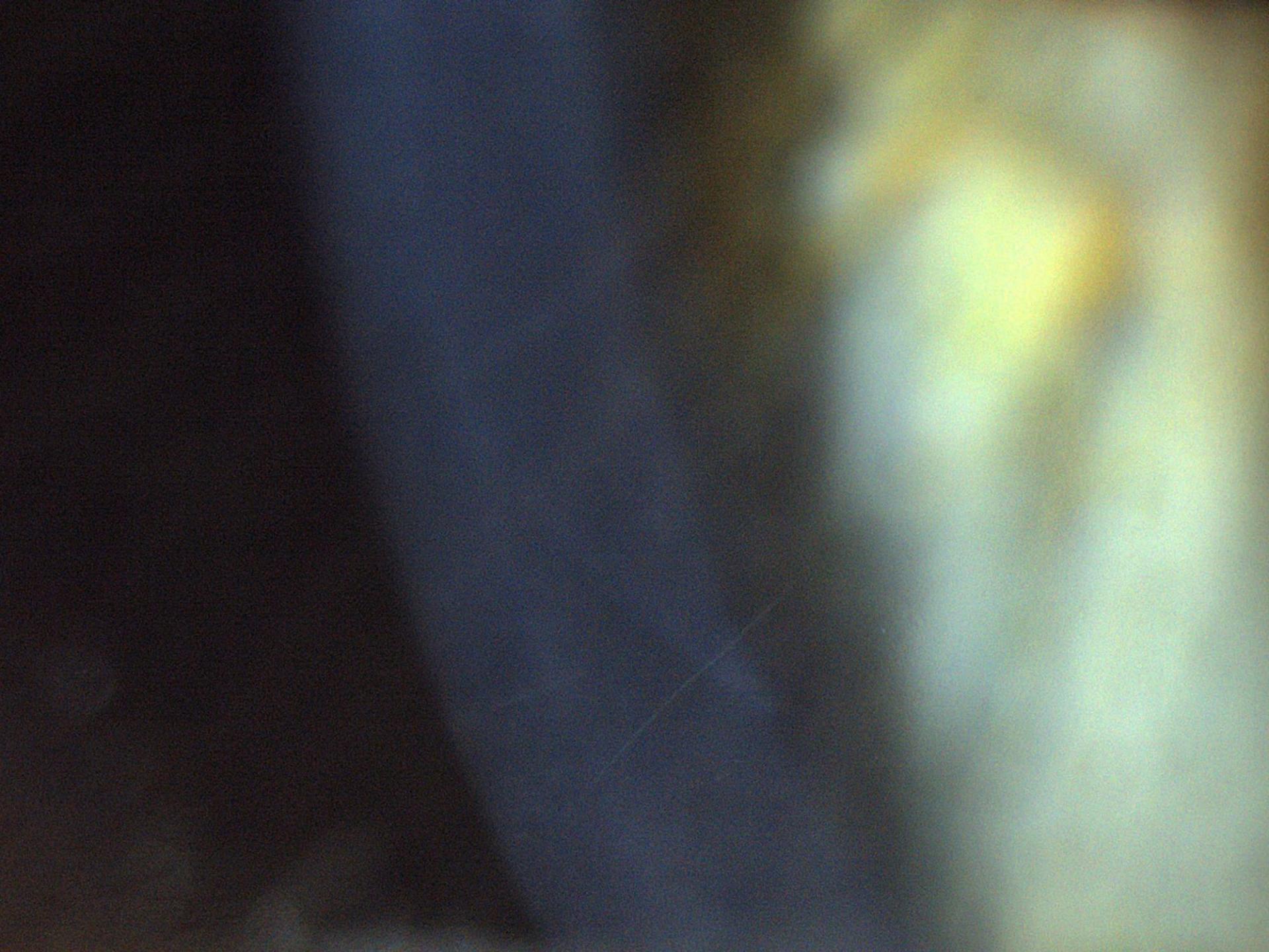 Faint corneal scars at high magnification after Lasik therapy