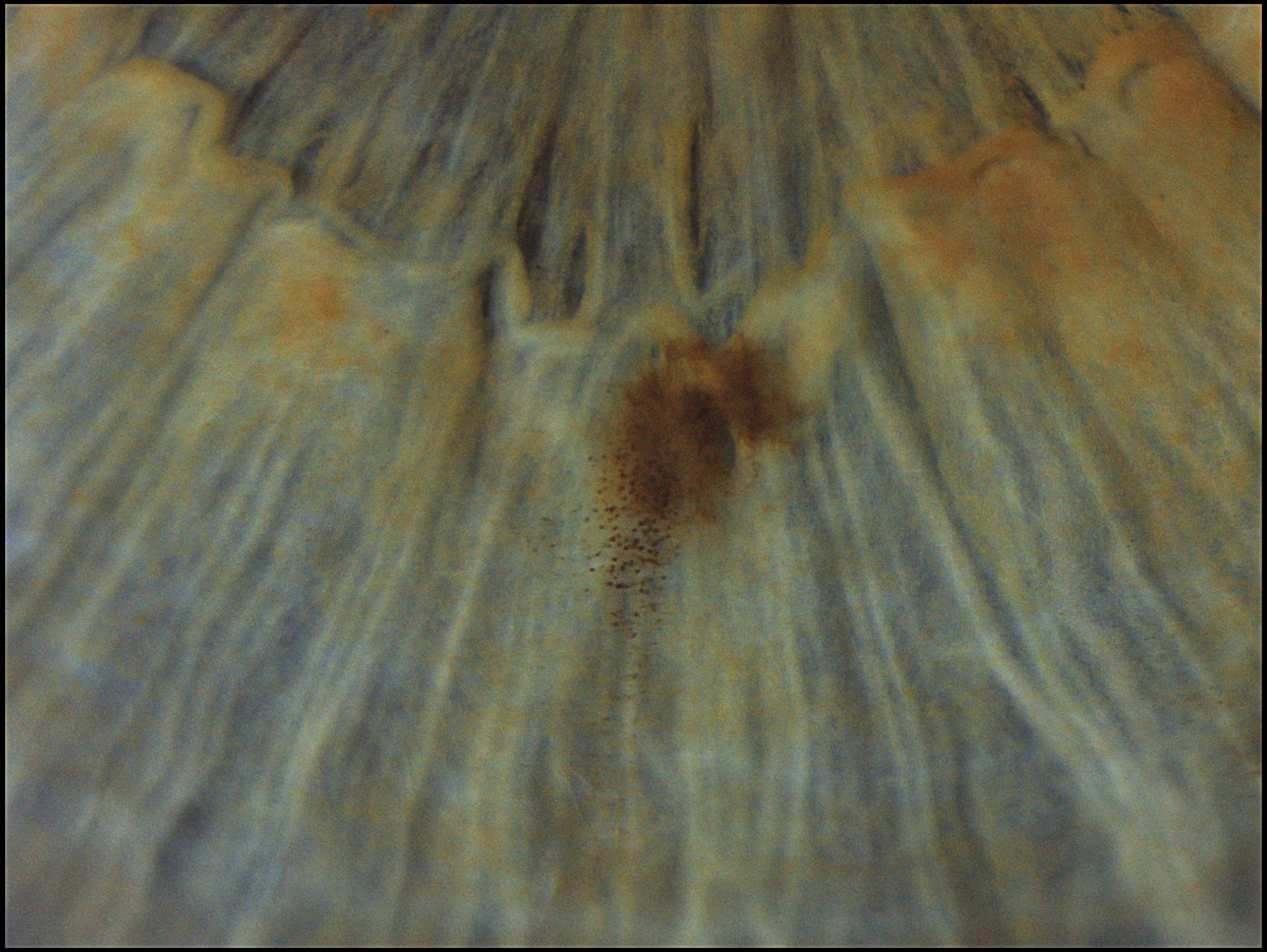 Small irisnevus with scattered nevus cells around