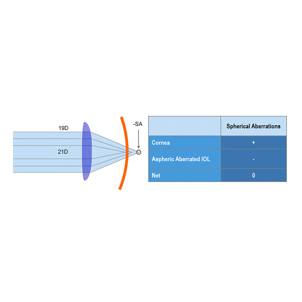 Schematic view of the aspheric, aberration-correcting IOL concept