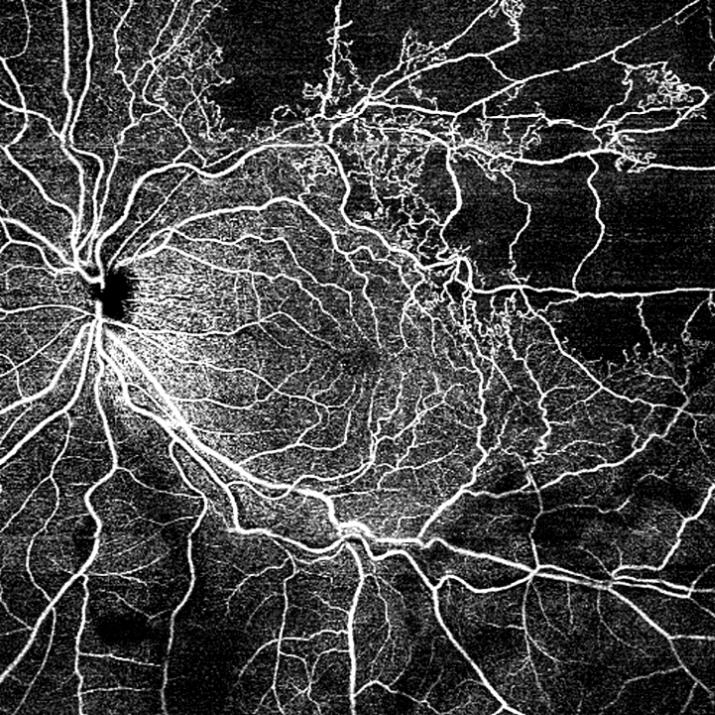 Amplíe su campo de visión más allá de los 45 grados